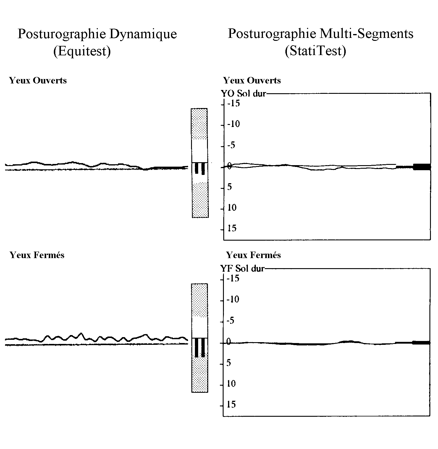 Equitest versus Statitest